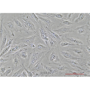 大鼠正常肾成纤维细胞NRK-49F