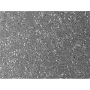 人大肠癌细胞CX-1