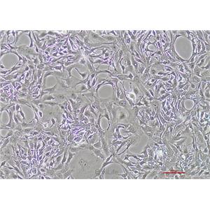 人胆管细胞型肝癌细胞Hccc9810