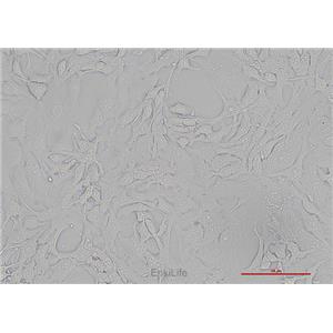 人胆管细胞型肝癌细胞Hccc9810