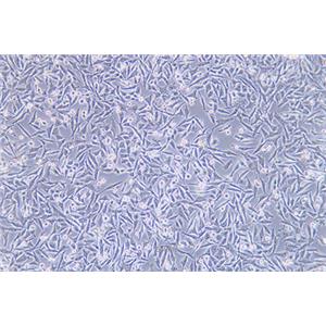 人恶性黑色素瘤细胞A375(STR鉴定) | EnkiLife恩玑生命