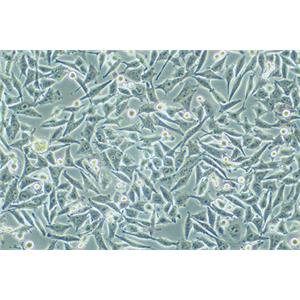 人恶性黑色素瘤细胞A375