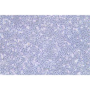 人恶性黑色素瘤细胞A375