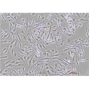 人恶性黑色素瘤细胞SK-MEL-28