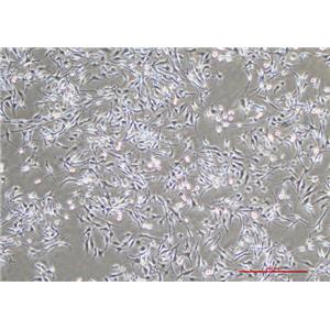 人恶性黑色素瘤细胞SK-MEL-28