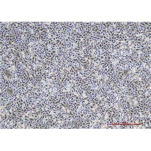 人非小细胞肺癌细胞 A549(STR鉴定) | EnkiLife恩玑生命