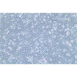 人非小细胞肺癌细胞NCI-H358