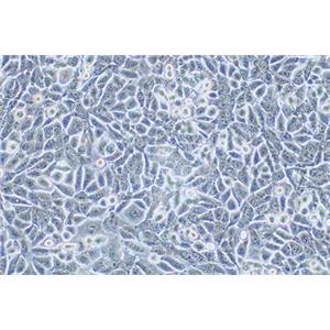 人非小细胞肺癌细胞NCI-H358