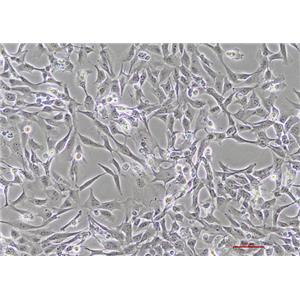 人肺癌细胞Calu-1(STR鉴定) | EnkiLife恩玑生命