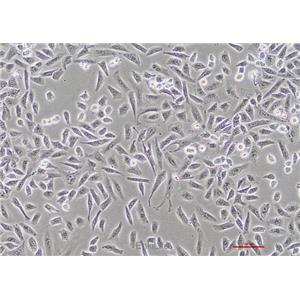 人肺癌细胞NCI-H1703 [H1703]