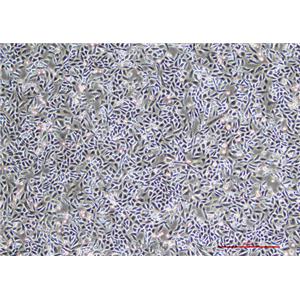 人肺癌细胞NCI-H1703 [H1703]