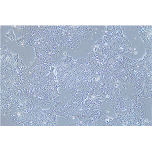 人肺癌细胞NCI-H2170