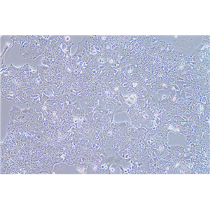 人肺癌细胞NCI-H2170