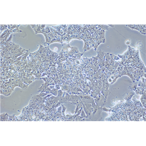 人肺癌细胞NCI-H2170