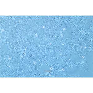 人肺癌细胞NCI-H2228