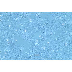 人肺癌细胞NCI-H2228