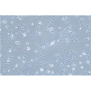 人肺鳞癌细胞HCC1588(STR鉴定) | EnkiLife恩玑生命