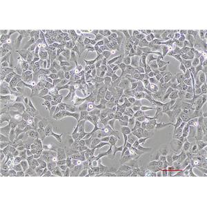 人肺腺癌细胞HCC4006