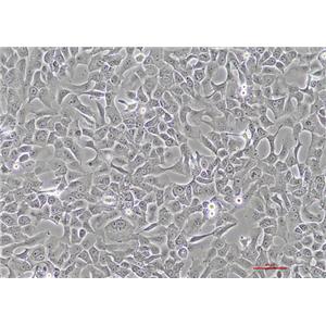 人肺腺癌细胞HCC4006