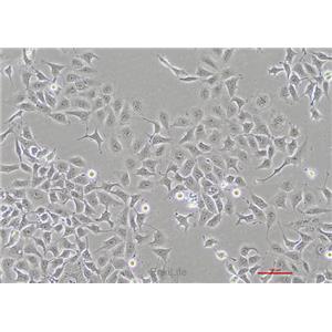 人肺腺癌细胞NCI-H1975