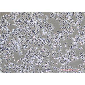 人肺腺癌细胞NCI-H1975