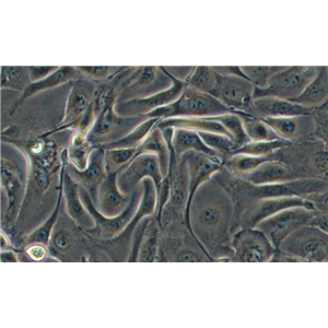 人肺腺癌细胞NCI-H3255