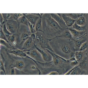 人肺腺癌细胞NCI-H3255