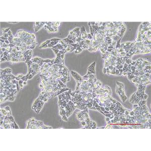 人肝癌细胞HepG2