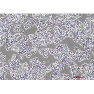 人肝癌细胞HepG2