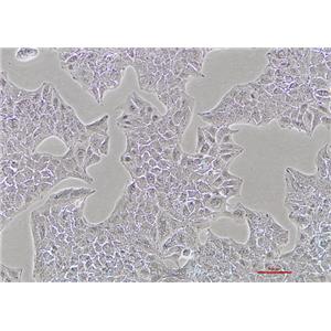 人肝癌细胞Li-7(STR鉴定) | EnkiLife恩玑生命