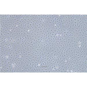 人肝癌细胞Mahlavu