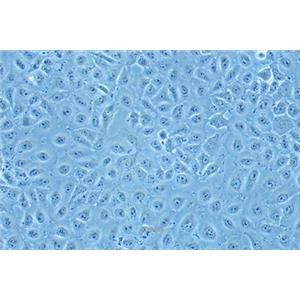 人肝癌细胞Mahlavu