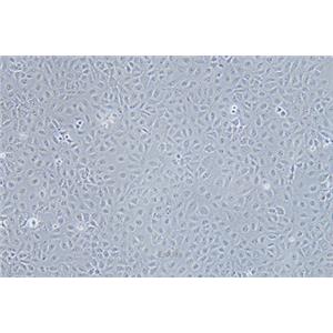 人肝癌细胞Mahlavu