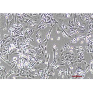 人肝癌细胞sk-hep-1