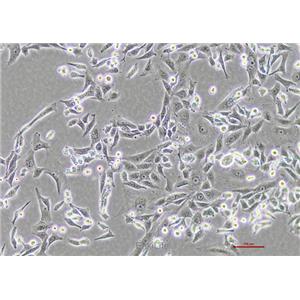 人肝癌细胞sk-hep-1