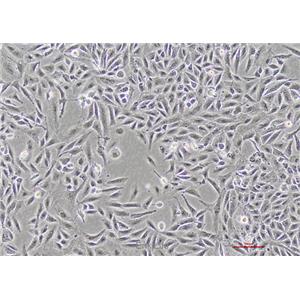 人肝癌细胞SNU-449(STR鉴定) | EnkiLife恩玑生命