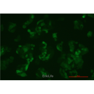 人肝癌细胞-绿色荧光标记HepG2-EGFP