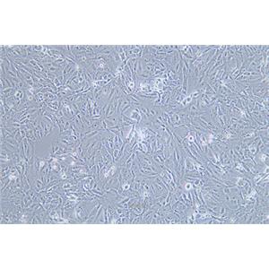 人骨肉瘤细胞143B