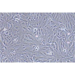 人骨肉瘤细胞143B