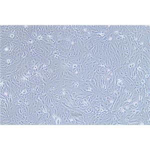 人骨肉瘤细胞143B