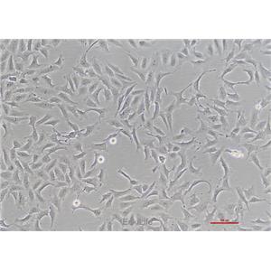 人骨肉瘤细胞HOS