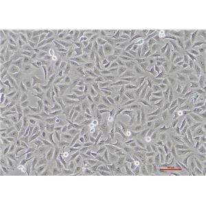 人骨肉瘤细胞HOS