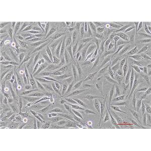 人骨肉瘤细胞MG-63