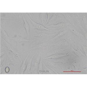 人骨肉瘤细胞MG-63