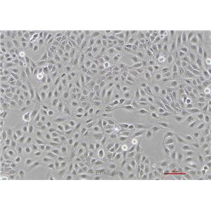 人骨肉瘤细胞U2OS(STR鉴定) | EnkiLife恩玑生命