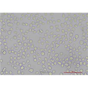 人骨髓瘤细胞NCI-H929(STR鉴定) | EnkiLife恩玑生命