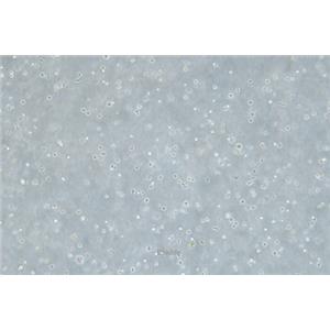 人骨髓瘤细胞U266