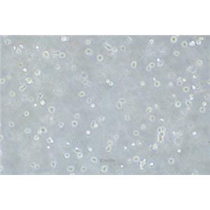 人骨髓瘤细胞U266