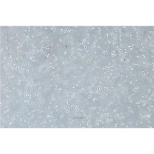 人骨髓瘤细胞U266