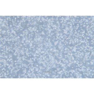 人骨髓增生异常综合征细胞MUTZ-1